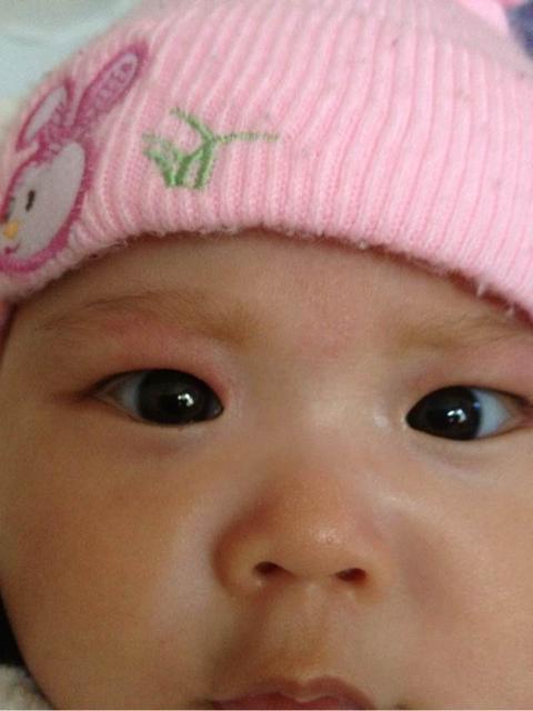 宝宝长湿疹该怎么办呢