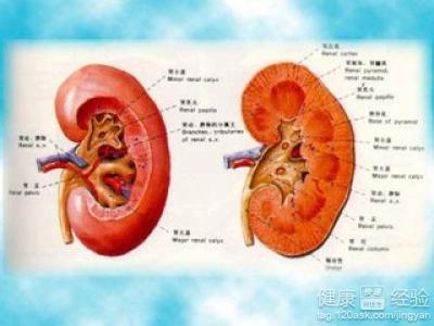 超声检出胎儿肾积水怎么办