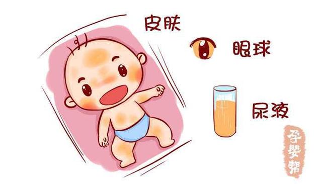 婴儿得黄疸怎么治疗