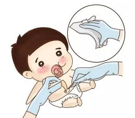 小孩肚脐脏了怎么办