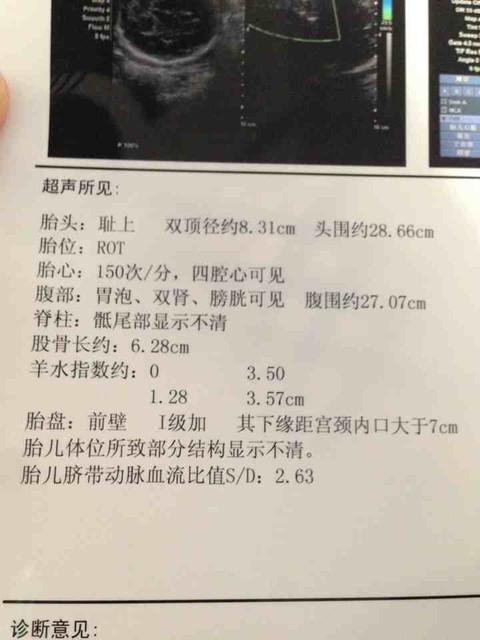 怎么给宝宝测量体重比较好