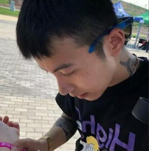 抖音网红关滤镜王北车一脸雀斑莉哥脸下垂猪鼻子不忍直视