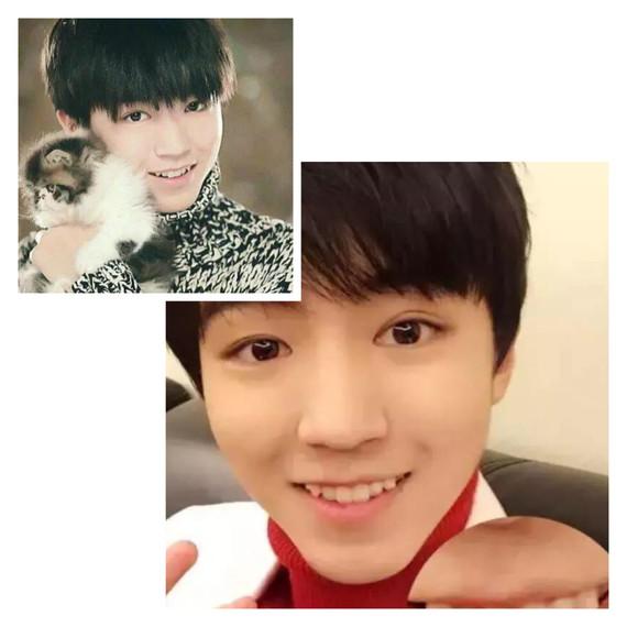 小孩矫正牙齿几岁可以开始做