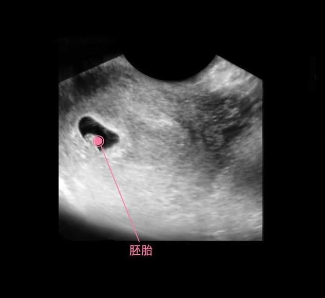 孕（17-20周）胎儿与孕妈妈的身体变化