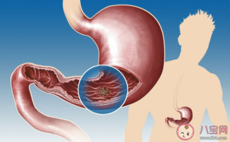 容易饿吃的多是怎么回事