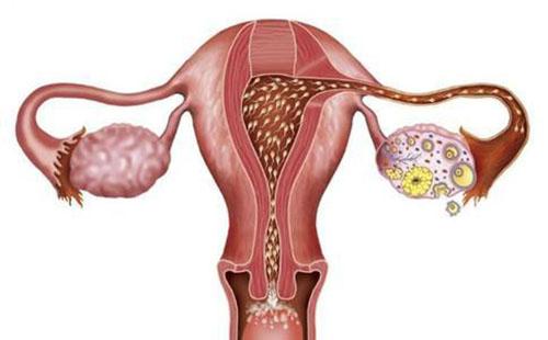 为什么年纪轻轻就有卵巢囊肿