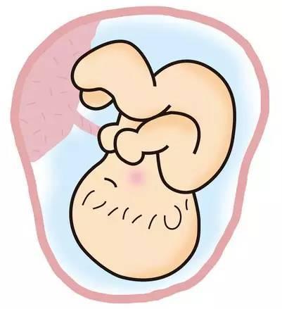 孕期宝宝脐带绕颈怎么办