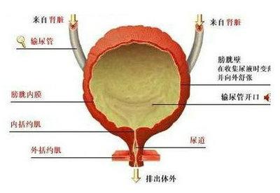 尖锐湿疣如果不治疗会怎么样