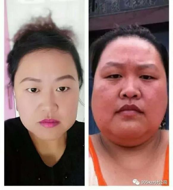 孩子地图舌怎么调理