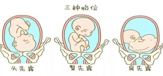 胎位不正应该怎么睡觉