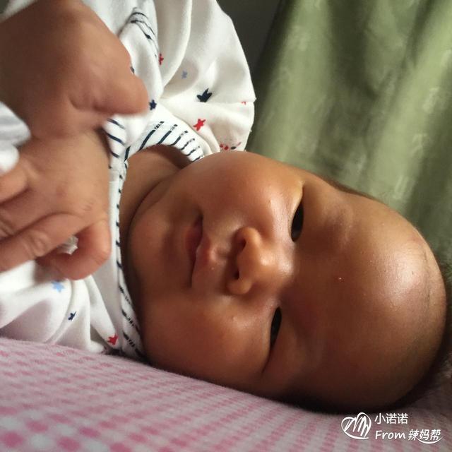 怎么判断宝宝黄疸已退了