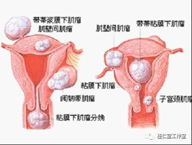 卵泡萎缩多久消失不见