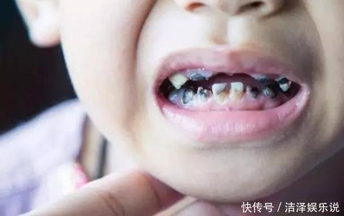 孩子刚长出的牙是黑色是怎么回事