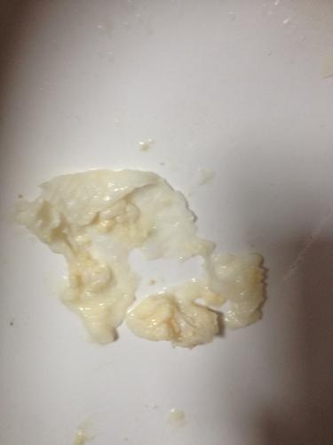 女生下面有白色豆腐渣一样的东西是什么不痛,不痒,没有味道