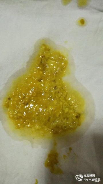 8个月宝宝拉肚子怎么办?