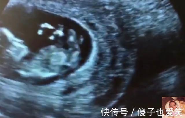 宝宝睡醒后为什么还打哈欠