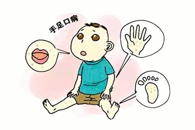 手足口病的预防措施有哪些