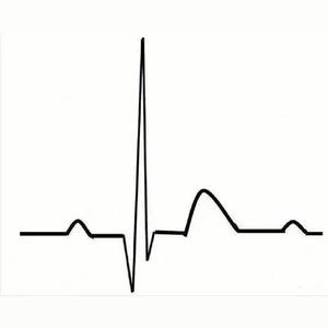 是利用心电图机从体表记录心脏每一心动周期所产生电活动变化的曲线图形