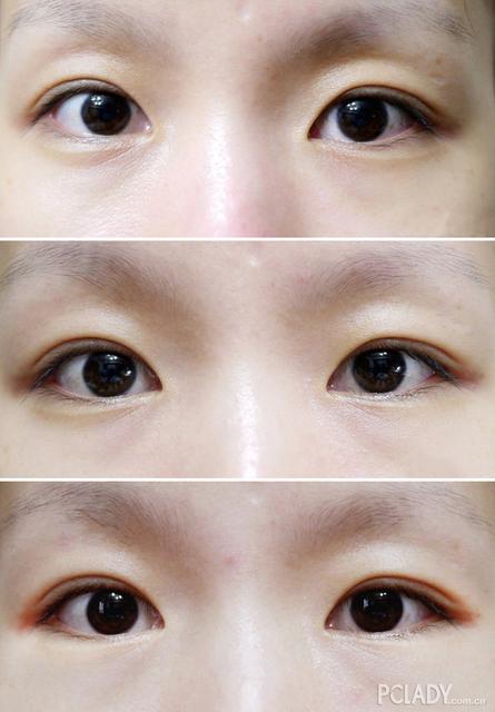 皮肤不好的原因有哪些