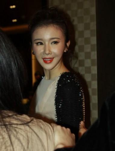 王菲张曼玉李小璐揭秘女星打玻尿酸内幕(图)