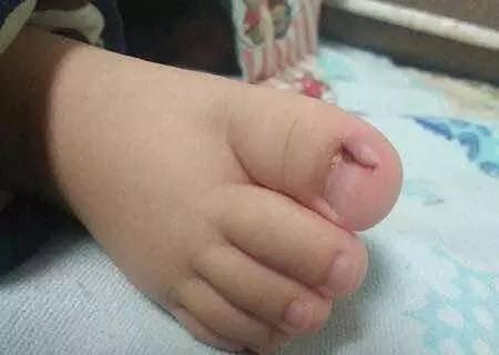 给小宝宝剪指甲的正确方法