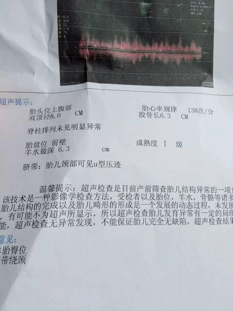 胎位不正是臀位怎么办