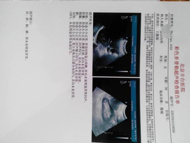胎儿超声检查是什么时候查的
