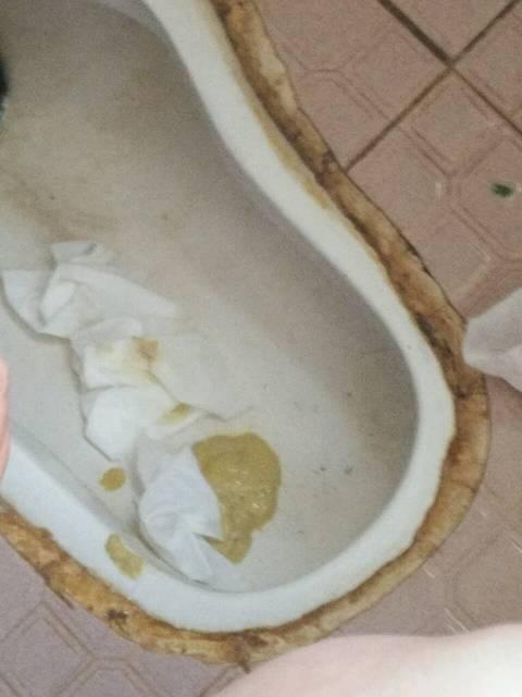 婴儿攒肚子的大便是什么颜色