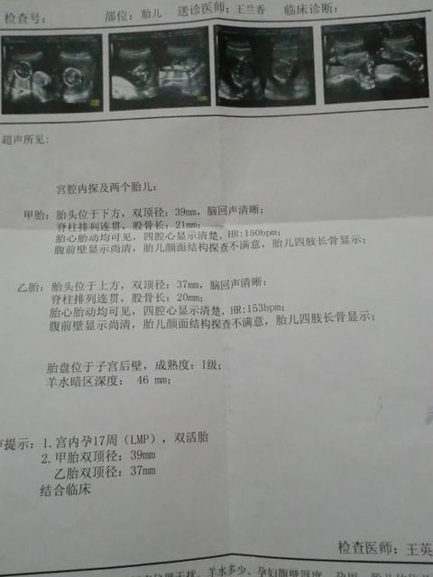 宝宝四个月大
