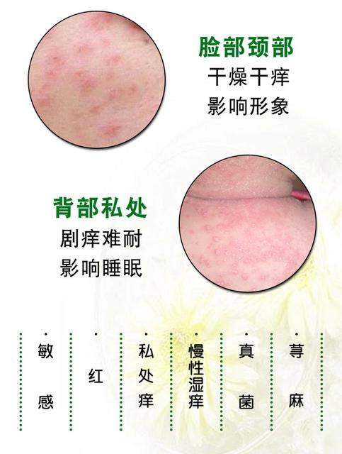 小儿隐私检查