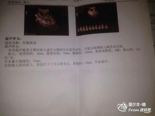 2019年9月28日受孕什么时候生