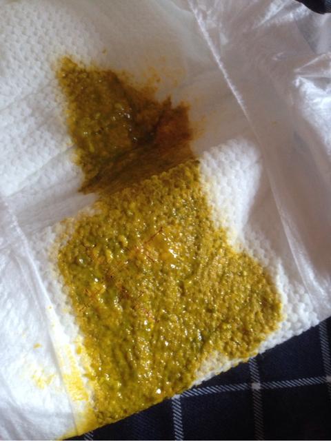 转奶粉拉肚子怎么办
