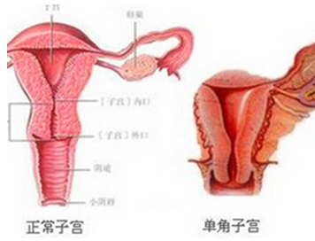 生殖健康对女性的影响