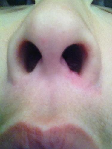 孩子鼻子不通气怎么办好点