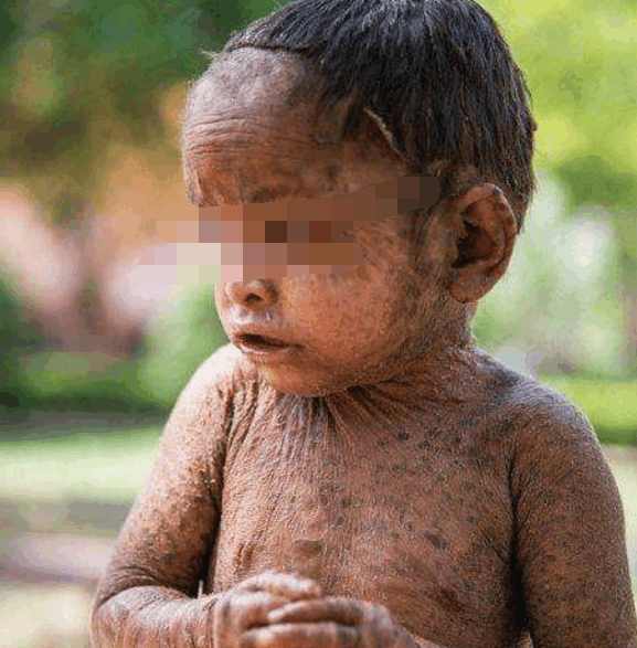 孕妈妈吃什么宝宝皮肤好