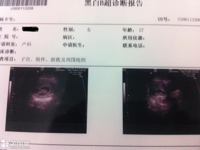 备孕四个月有好孕吗