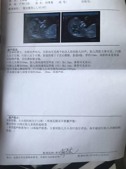 孕妇双绒双羊什么意思