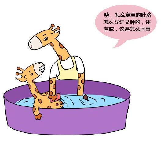 新生儿肚脐如何护理