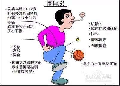 小儿阑尾炎的症状有哪些