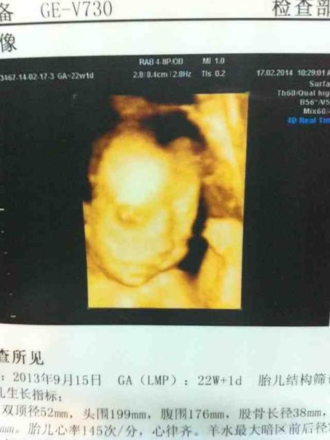 形容孩子感冒心疼说说