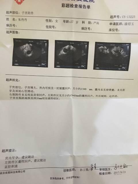 男人眉毛浓就能生男孩吗