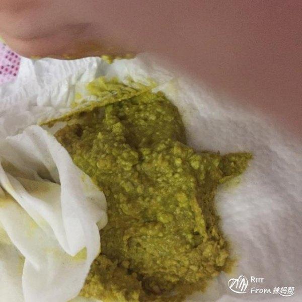 吃奶粉宝宝消化不良怎么办?