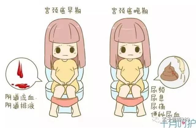 女性如何自查乳腺癌