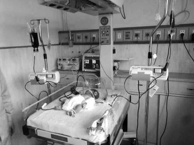 新生儿溶血症的原因是什么