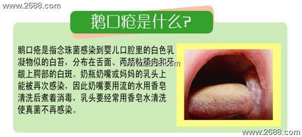 宝宝生鹅口疮怎么办