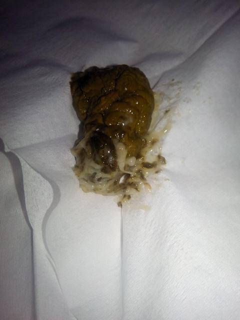 大便小便拉不出来是什么原因