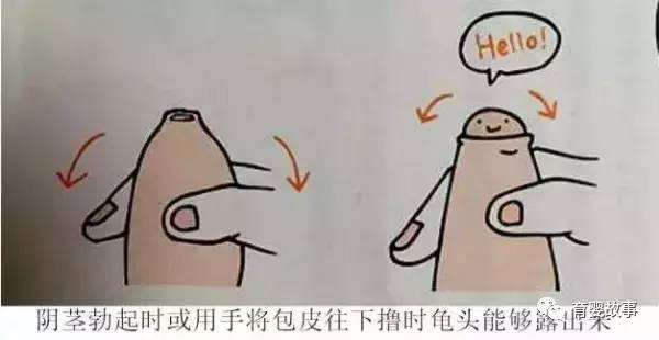 男孩子包茎什么时候割