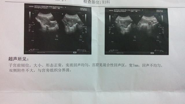 药流后出血几天算是正常的