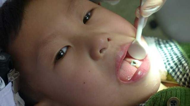 孕妇如何保护好自己牙齿