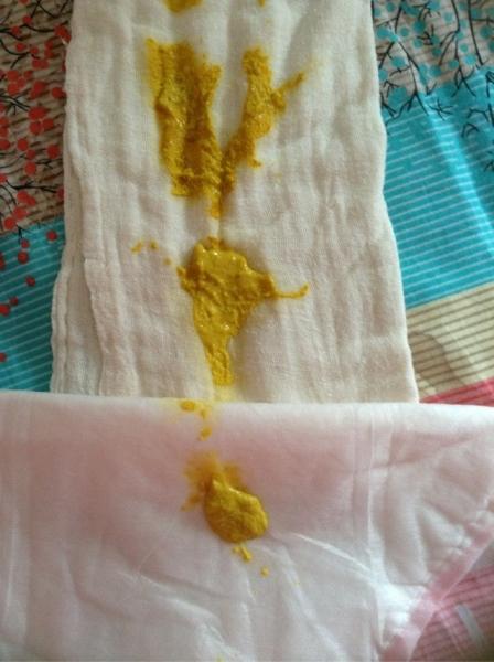 乳糖不耐受是一种病吗
